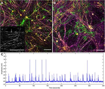 An Improved in vitro Model of Cortical Tissue